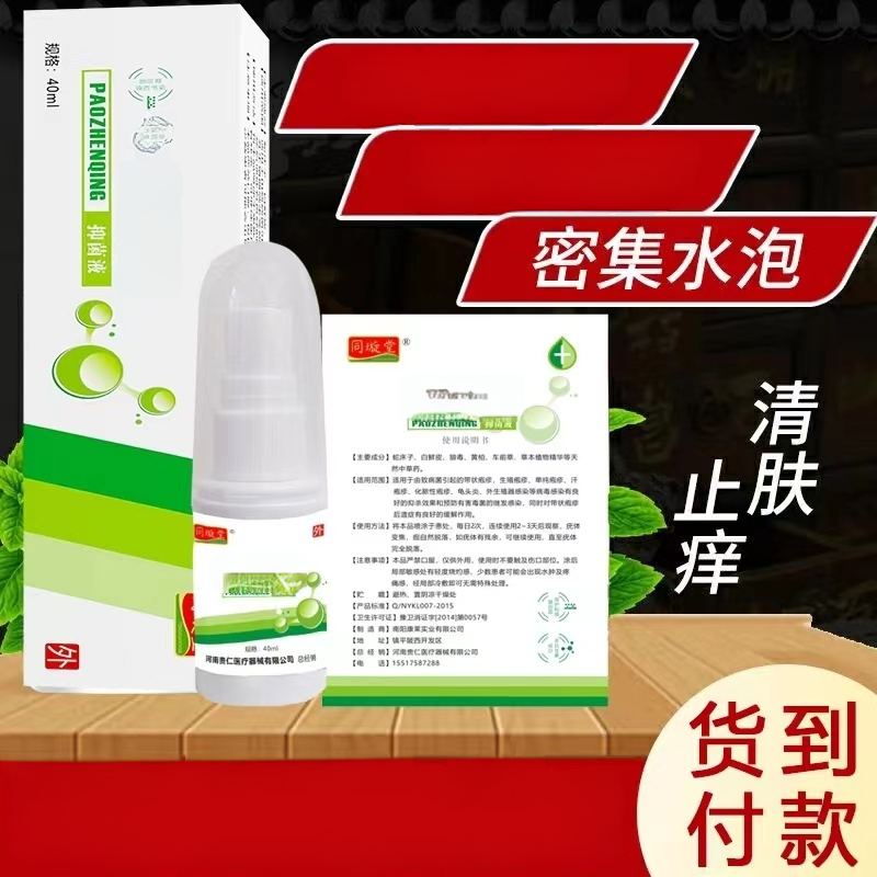祛疱灵男女私密生殖防复发病毒根刺痛星药带状痒红点白斑异味修复