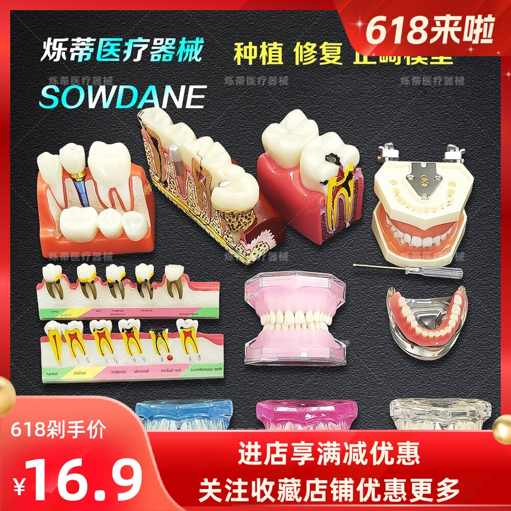 牙科口腔病理修复模型/种植模型/正畸讲解模型医患沟通教学牙模