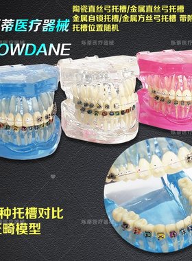 牙科正畸模型齿科口腔护理