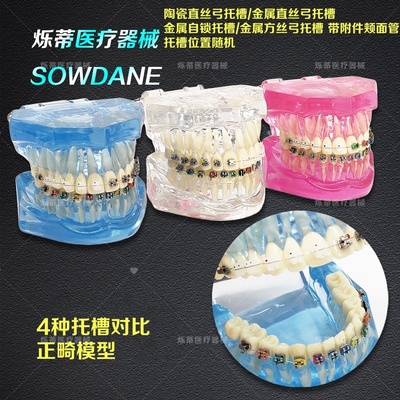 牙科正畸模型齿科口腔护理