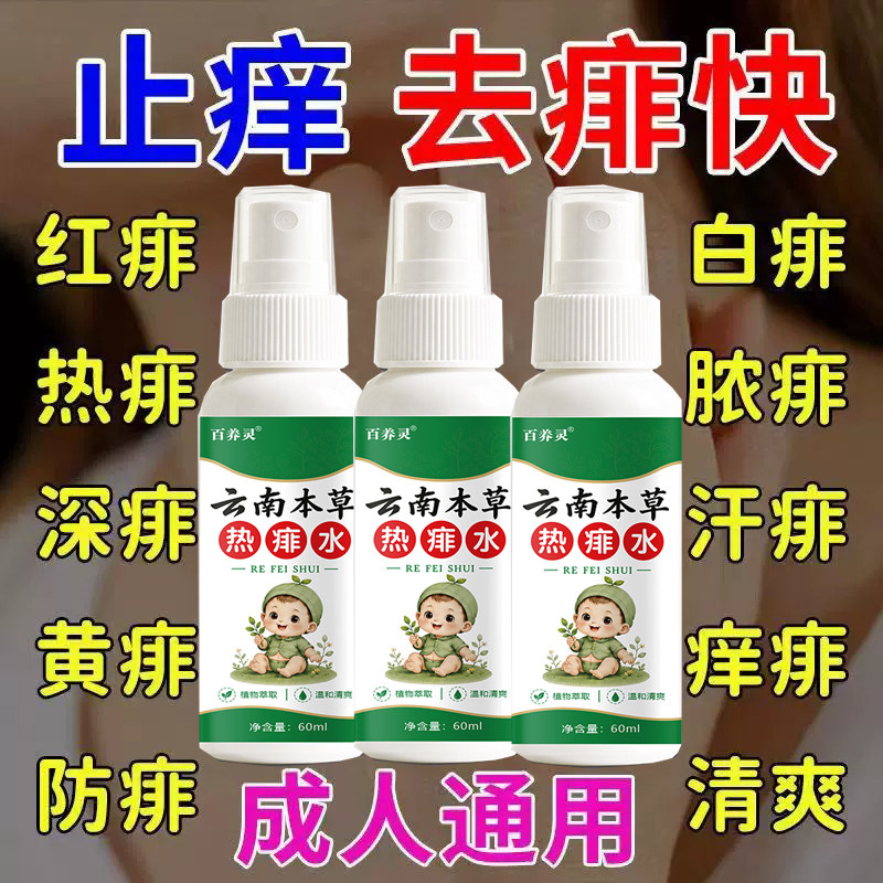 老牌痱子水成人专用止痒去痱大人儿童热痱水祛痱金银花喷雾花露水