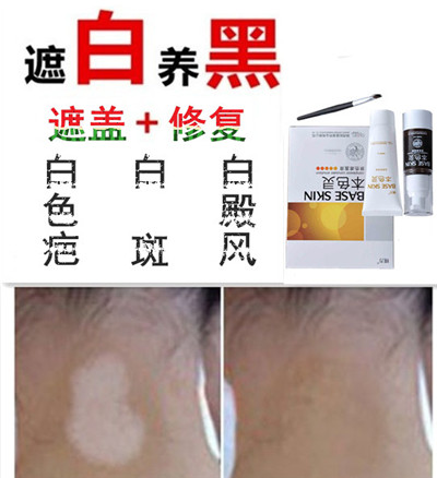 防水型白印遮瑕膏白印白疤疤痕遮盖膏白斑净肤蜡遮盖霜贴防水耐磨在类目 彩妆/香水/美妆工具, 遮瑕中 - 来自Buy2taobao.com提供专业的淘宝代购服务