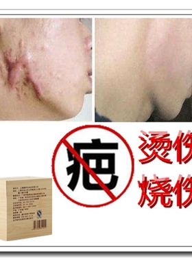 祛耳洞肉疙瘩剖腹产后遮盖修复膏黑色素沉淀去除烫烧伤疤痕灵药粉