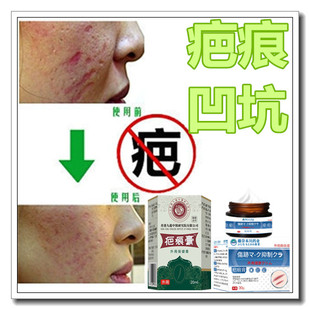 祛手术修复膏软化增生性凸疙瘩祛除破宫产伤疤痕印灵烟疤沉着色素