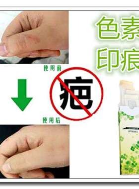 疤痕印正品去除黑色素沉淀去手术伤痕疙瘩淡化色素印沉着修复膏霜