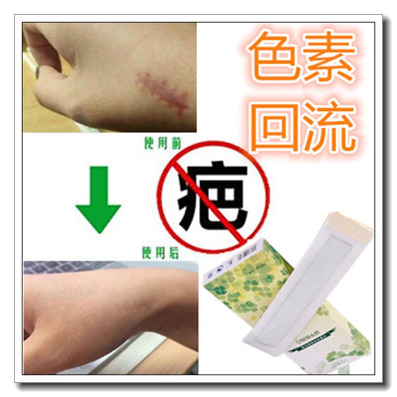 祛除手术后黑色素沉着去男女痘疤痕印霜正品护肤品阻断返黑印回流