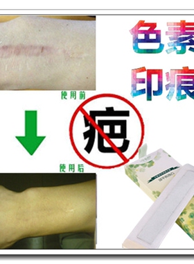 祛暗沉红印霜去除凸疤痕印疙瘩消除黑色素沉淀回流褪黑色素印正品