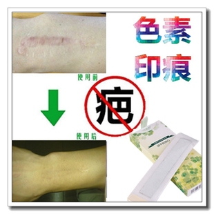 祛暗沉红印霜去除凸疤痕印疙瘩消除黑色素沉淀回流褪黑色素印正品