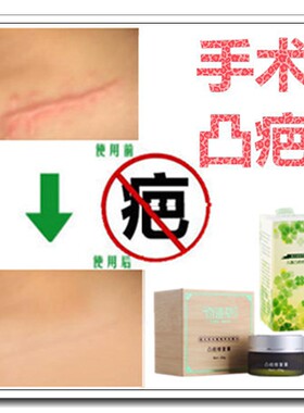 除剖腹产增生凸起软化胸前缝针疙瘩去烫伤刀疤痕体质祛黑疤乐神器
