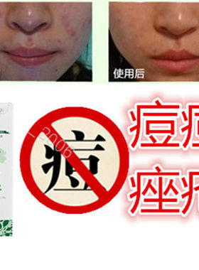 产品男女祛除后背部封闭合性痘痕青春痘痘印去胸前豆豆痤疮精华霜
