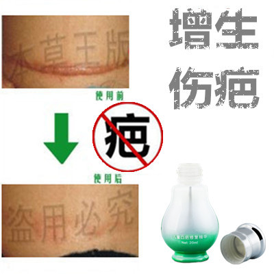 祛疙瘩修复增生性凸出手术缝针剖腹产刀伤巴痕纹身抓伤摔伤撞伤液