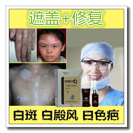 外用脸上白斑遮盖液药膏神器祛白殿风遮瑕霜防汗持久耐磨正品防水