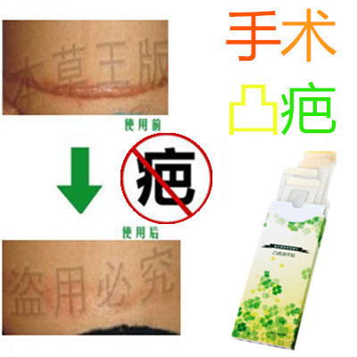 祛增生性凸疤缝针疙瘩产后开刀割伤巴痕灵除去手术冻疮色素印产品