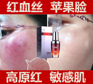 修复霜祛小疹子红肿疼痒去除脸上红血丝增强免疫受损舒缓敏感肌肤