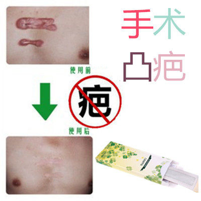 去增生性体质修复凹凸软化疙瘩开刀割伤巴痕灵祛除手术产后色素药