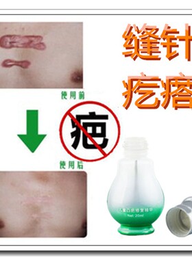 去除烫伤软膏淡化沉淀修复蚊子叮咬疤痕改善皮肤暗沉发黄褪黑色素