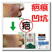 去凸疤疙瘩烟烫增生性体质手术剖腹产伤疤痕印灵纹身缝针沉着色素