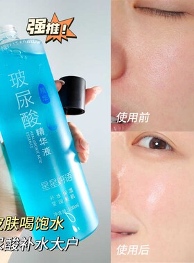 星星妍语玻尿酸补水修护爽肤水