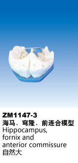 ZM1147-3海马解剖模型，穹窿解剖模型，前联合解剖模型
