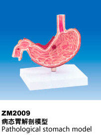 ZM2009病态胃解剖模型
