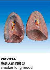 ZM2014吸烟人的肺解剖模型