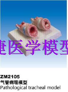 ZM2105气管病理模型