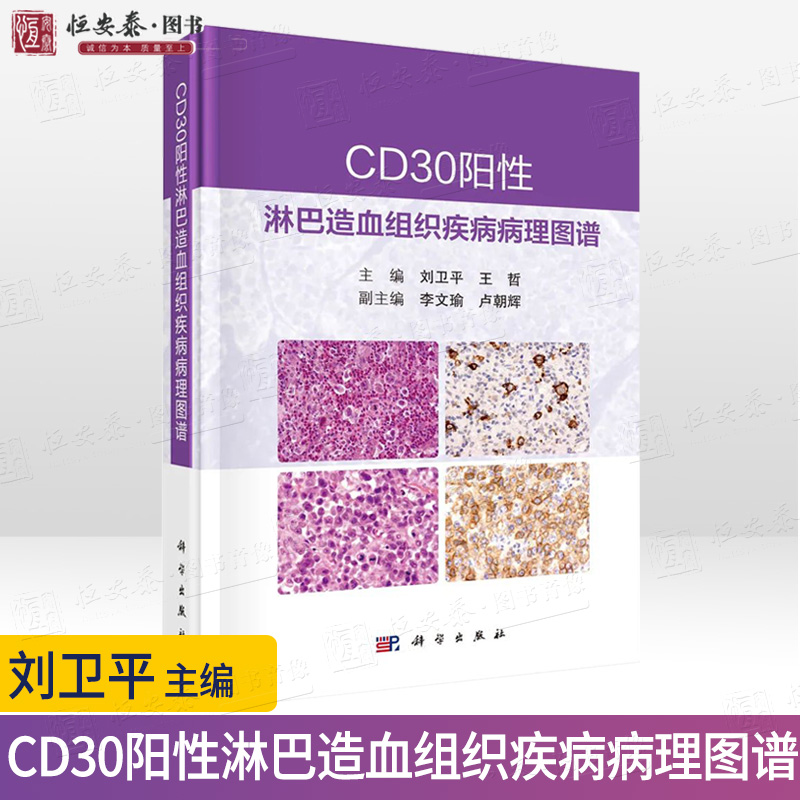 【2022新版】CD30阳性淋巴造血组织疾病病理图谱刘卫平王哲主编恶性肿瘤血液肿瘤临床诊治肿瘤学淋巴组织肿瘤淋巴组织增生性疾病-封面