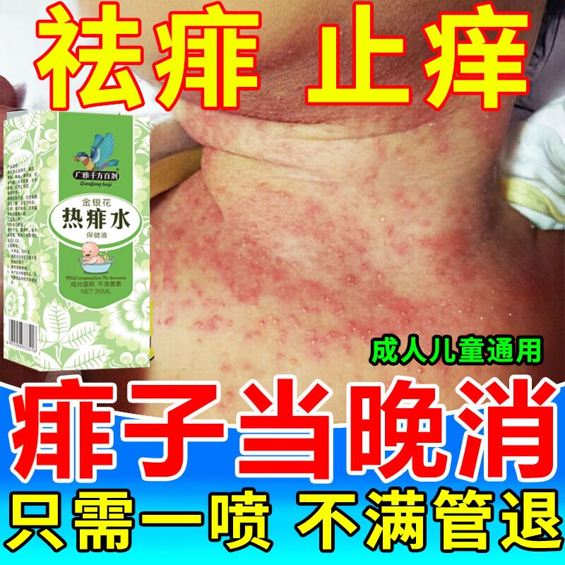 婴幼儿脖子腋下防淹脖子专用红白痱子水止痒去痱菲热痱水防淹神器