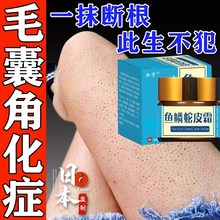 毛周角化症鸡皮肤疙瘩毛囊角化药膏去除儿童手臂腿上角质消除神器