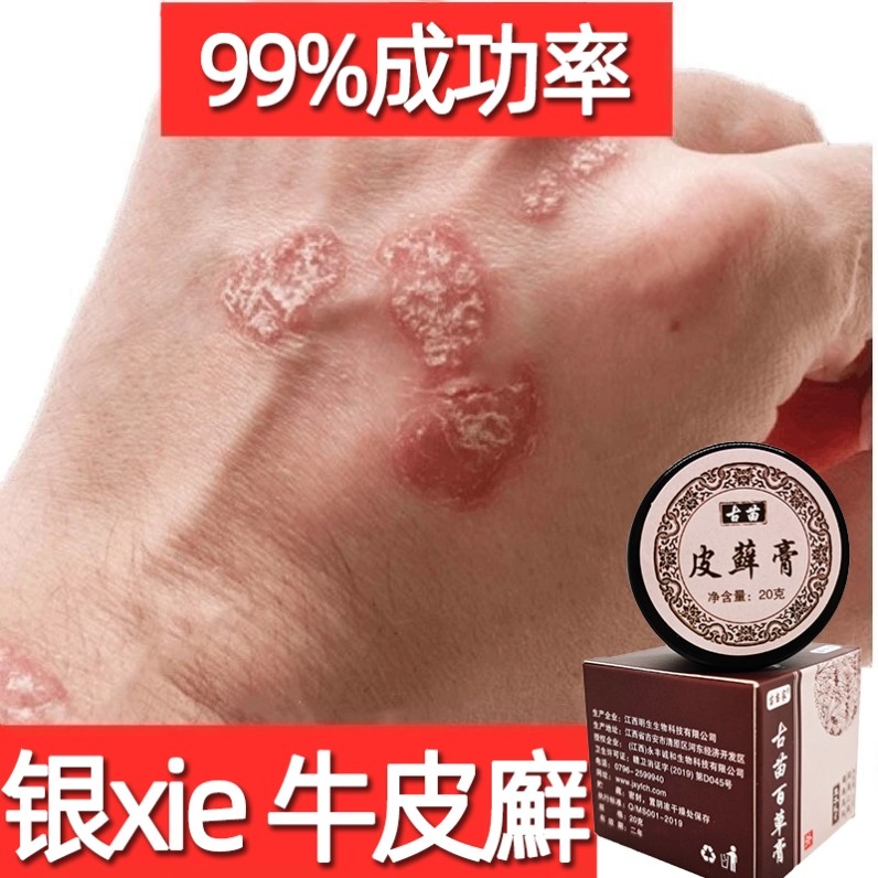 皮毒清软膏苗王本草云南本草止痒灵苗族独方神农百草膏苗药皮癣王