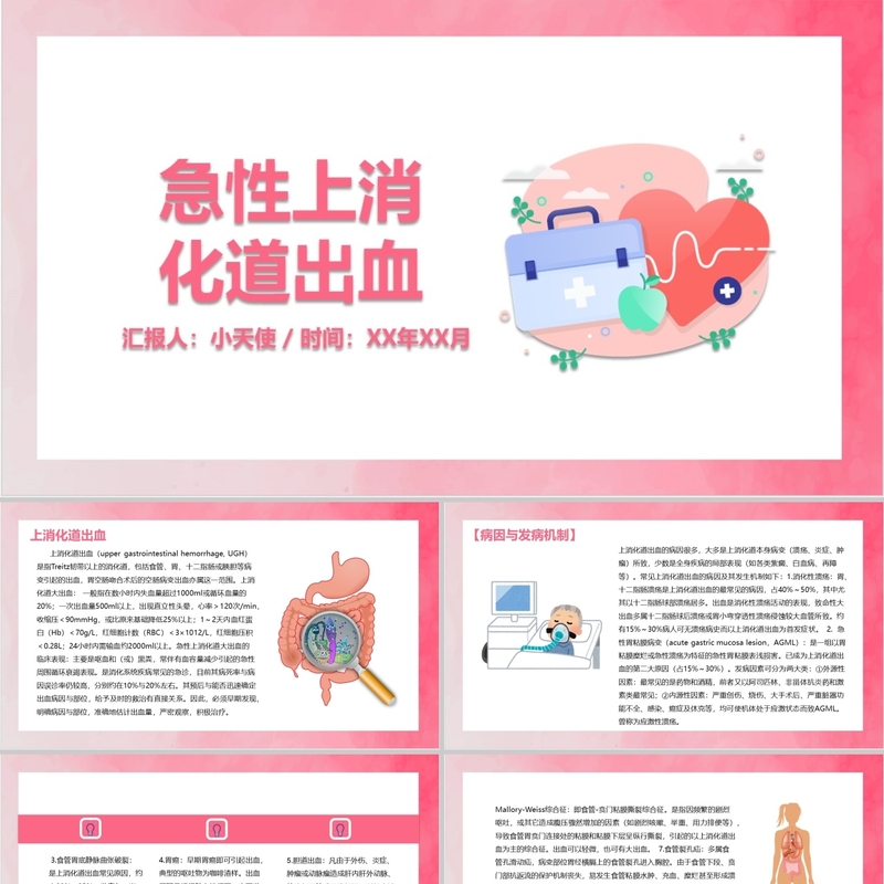 PPT代制作医护粉色简约风急性上消化道出血护理查房PPT模板
