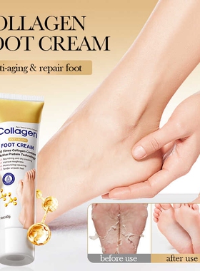 CollagenAnti-wrkfmc足