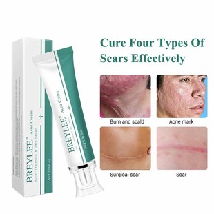 Acne Scar Removal Cream Skin Repair Face Cream 修复膏