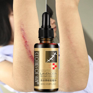 Remove Acne Scars Pregnant woman stretch marks Lavender oils