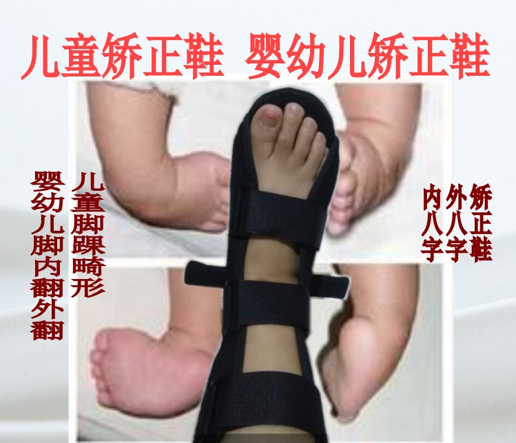 婴幼儿新生儿童矫正鞋内八字外八字足内翻足外翻O型腿固定矫正鞋