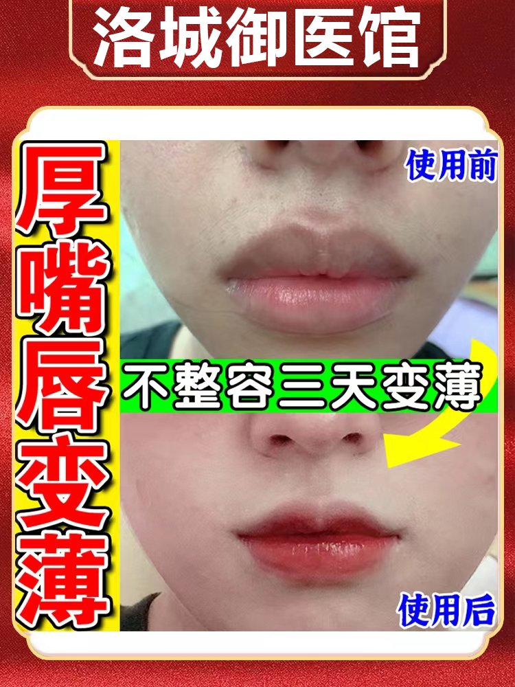 瘦唇膏嘴唇变薄变小神器改善香肠嘴缩小嘴巴太厚唇纹嘴唇发黑矫正