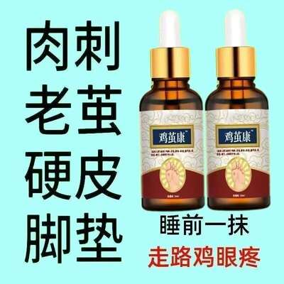 【鸡茧康】去除脚茧老茧手足厚茧硬皮鸡眼身体脚趾关节茧脚垫老茧