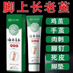 脚底老茧去除软化剂脚底死皮脚跟脚垫硬皮鸡茧眼膏脚钉祛除鸡茧膏