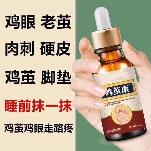 【鸡茧康】去除脚底老茧手足厚茧硬皮鸡眼膏脚趾关节茧脚垫软化剂