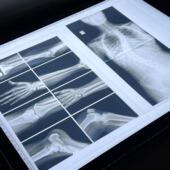 瑞吉欧发光桌人体动物X光胶片透光片区角光影游戏医院角色扮演