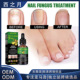 Repair Foot Liquid Nail Hand Care Moi