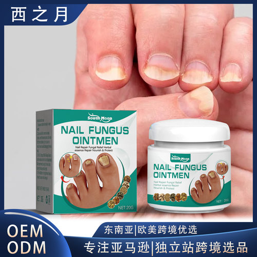 Grey Nail Cream Hand and Foot Rotten Toenail Care Thickening