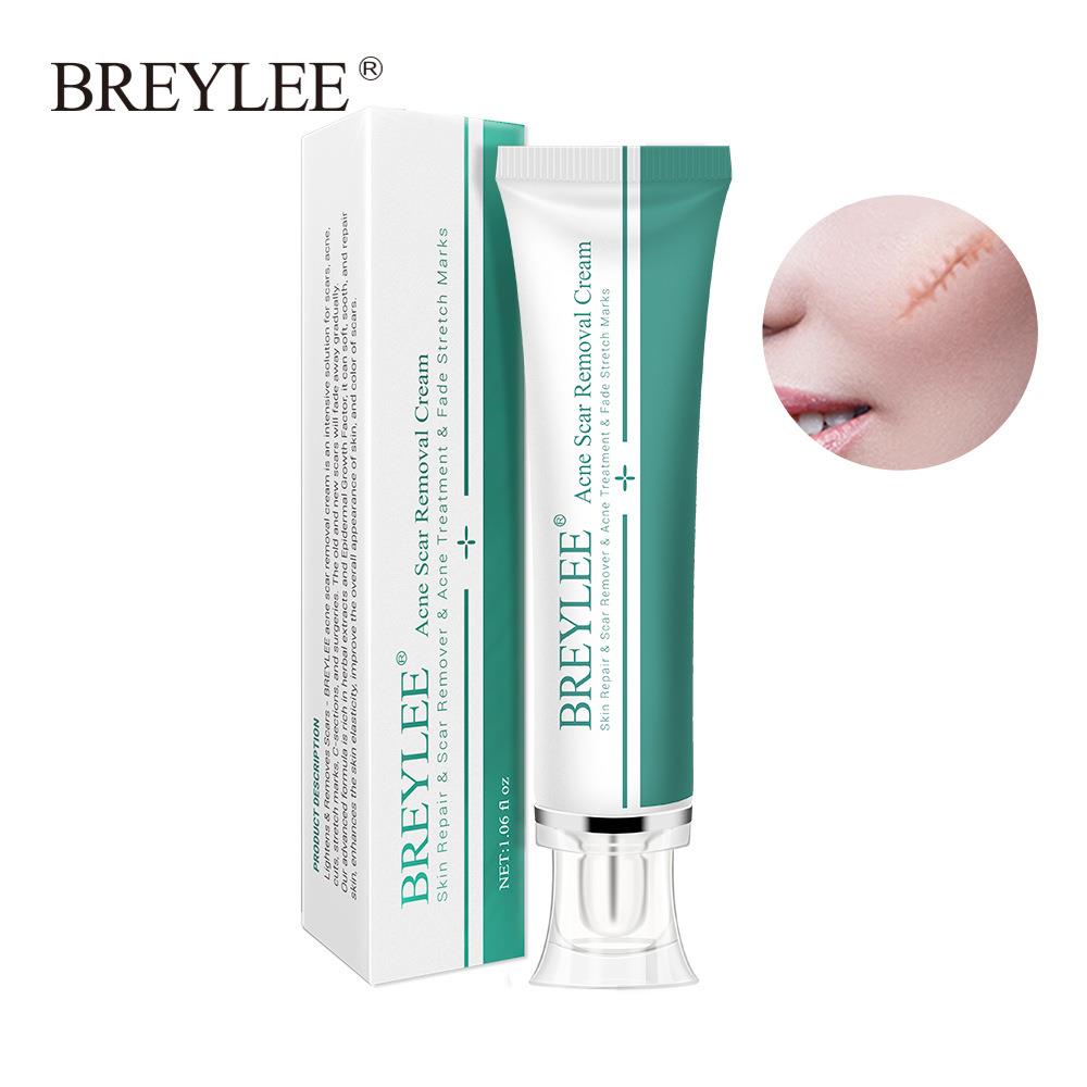 Acne Scar Removal Cream Face Repair Skin Whitening 30g cream