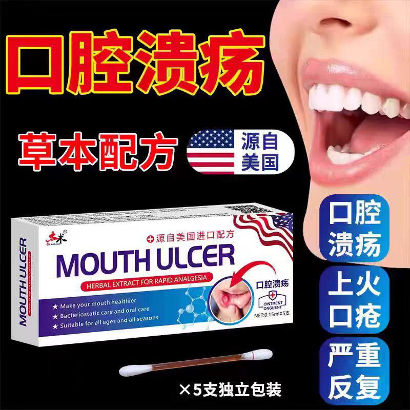 口腔溃疡专用一点灵烂嘴巴烂舌头上火起泡口疮牙龈肿痛消止痛药焱