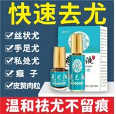 克尤液祛丝状尤去除脖子颈部头部腋下小肉粒瘊子疙瘩全身去除神器