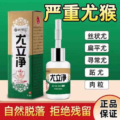 尤立净去除扁平丝状尤瘊肉猴脖子腋下手脚寻常跖尤去尤液不留疤灵