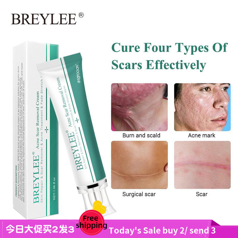 Acne Scar Removal Cream Face Repair Skin Whitening cream30g 美容护肤/美体/精油 液态精华 原图主图