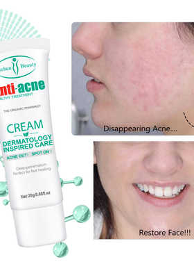 Anti Acne Cream Face Skin Care Anti Blemish Treatment
