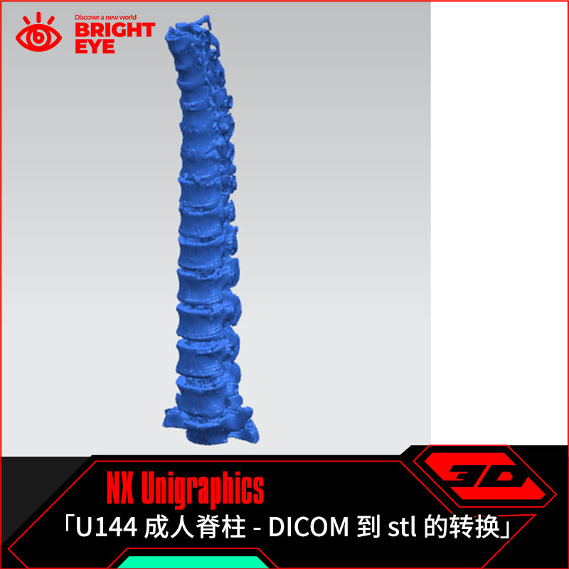 成人脊柱stl ug模型库NX三维prt装配结构零件stp建模标准件图纸
