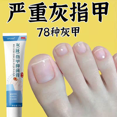 正品灰指趾甲草本液坏甲增厚发黄萎缩甲沟外用指甲膏亮甲